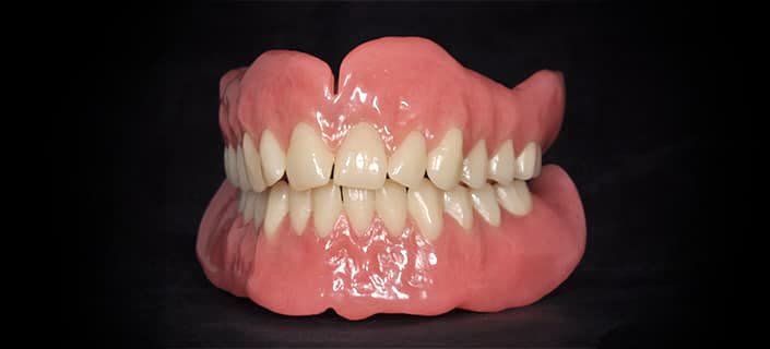 Nahaufnahme einer Zahnprothese mit Ober- und Unterkiefer