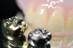 Close-up of two metallic dental crowns in front of a dental prosthesis model