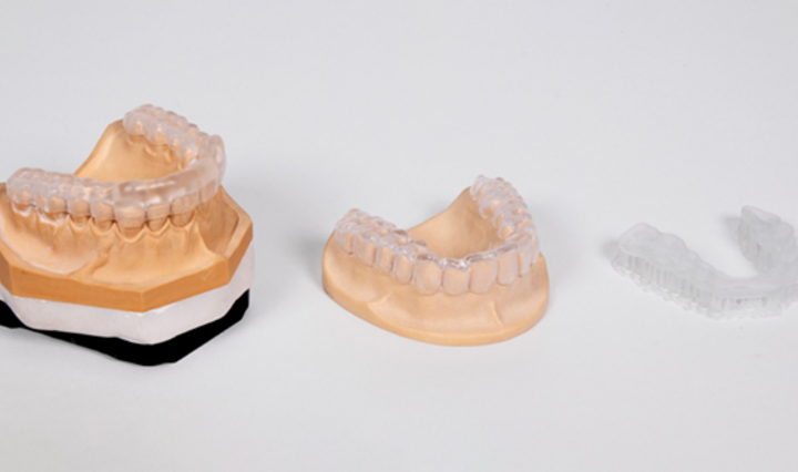 Okklusionsschienen aus klarem Kunststoff, aufgestellt auf Zahnmodellen aus Gips, auf weißem Hintergrund