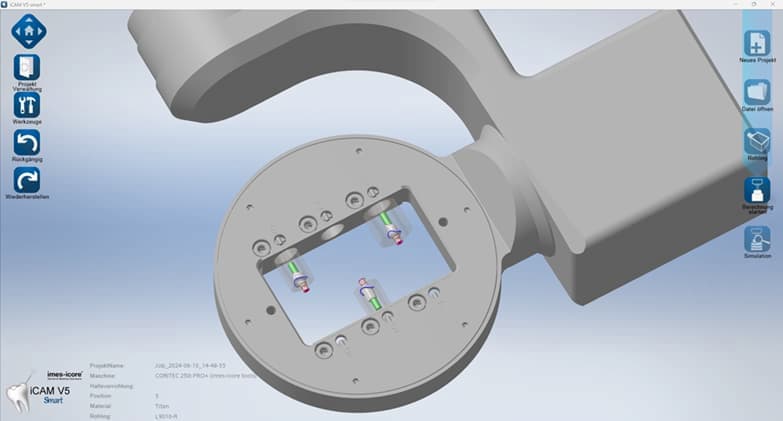 iCAM HD Screenshot - 3 Abutments im 6-fach Medentika Abutmenthalter