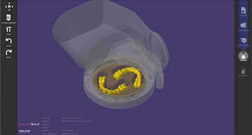 Visualisierung eines 3D-gedruckten Zahnmodells in der Dentalsoftware-Ansicht.