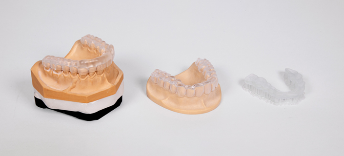 Okklusionsschienen aus klarem Kunststoff, aufgestellt auf Zahnmodellen aus Gips, auf weißem Hintergrund